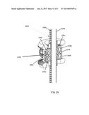 HYPERDEXTEROUS SURGICAL SYSTEM diagram and image