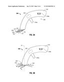 INCISIONAL HERNIA CUT LINE METHOD AND DEVICE diagram and image