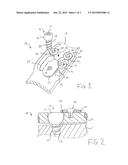 Orthopedic Plating Assembly For Bone Fixation and Subsidence diagram and image