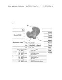 ARTIFICIAL KNEE JOINT diagram and image