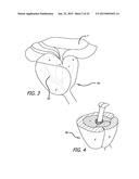 CONTINUOUS INDENTATION LATERAL LOBE APPARATUS AND METHOD diagram and image