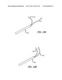 CONTINUOUS INDENTATION LATERAL LOBE APPARATUS AND METHOD diagram and image