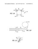 CONTINUOUS INDENTATION LATERAL LOBE APPARATUS AND METHOD diagram and image