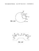 CONTINUOUS INDENTATION LATERAL LOBE APPARATUS AND METHOD diagram and image