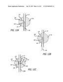 CONTINUOUS INDENTATION LATERAL LOBE APPARATUS AND METHOD diagram and image