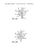 CONTINUOUS INDENTATION LATERAL LOBE APPARATUS AND METHOD diagram and image