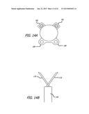 CONTINUOUS INDENTATION LATERAL LOBE APPARATUS AND METHOD diagram and image