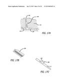 CONTINUOUS INDENTATION LATERAL LOBE APPARATUS AND METHOD diagram and image