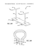 CONTINUOUS INDENTATION LATERAL LOBE APPARATUS AND METHOD diagram and image