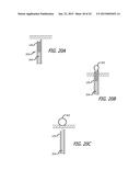 CONTINUOUS INDENTATION LATERAL LOBE APPARATUS AND METHOD diagram and image