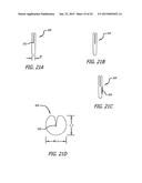 CONTINUOUS INDENTATION LATERAL LOBE APPARATUS AND METHOD diagram and image