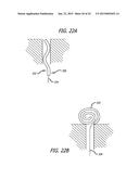 CONTINUOUS INDENTATION LATERAL LOBE APPARATUS AND METHOD diagram and image