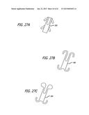 CONTINUOUS INDENTATION LATERAL LOBE APPARATUS AND METHOD diagram and image