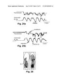 NEUROMORPHIC CONTROLLED POWERED ORTHOTIC AND PROSTHETIC SYSTEM diagram and image