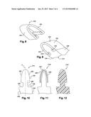 METHOD FOR DISASSEMBLING A REINFORCEMENT FROM A PART diagram and image