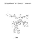 DEVICE FOR THE ATTACHMENT OF CORRECTION WEIGHTS FOR UNBALANCE CORRECTION diagram and image