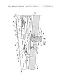 QUICK CHANGE MOLD SYSTEM diagram and image