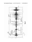 ACCELEROMETERS IN AN AREA diagram and image