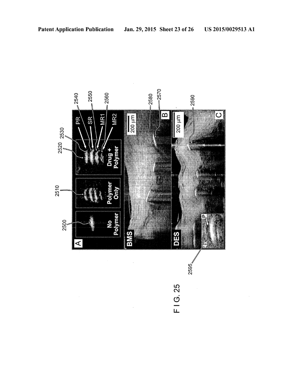 SYSTEMS, METHODS AND COMPUTER-ACCESSIBLE MEDIUM WHICH PROVIDE MICROSCOPIC     IMAGES OF AT LEAST ONE ANATOMICAL STRUCTURE AT A PARTICULAR RESOLUTION - diagram, schematic, and image 24