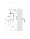 FIXED SUCTION CHAMBER WITH REAR AND FRONT SEAL REMOVAL diagram and image