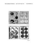 ANTIMICROBIAL MATERIAL COMPRISING A METAL ION CHARGED ON SYNTHESIZED     ZEOLITE diagram and image