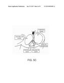 Use of Stem Cells to Generate Inner Ear Cells diagram and image