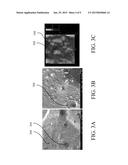 BONE REGENERATION USING BIODEGRADABLE POLYMERIC NANOCOMPOSITE MATERIALS     AND APPLICATIONS OF THE SAME diagram and image