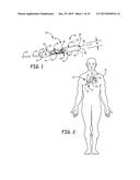ELONGATE BATTERY FOR IMPLANTABLE MEDICAL DEVICE diagram and image