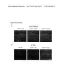 RHO KINASE INHIBITORS FOR USE IN TREATING AMYOTROPHIC LATERAL SCLEROSIS diagram and image