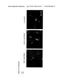 RHO KINASE INHIBITORS FOR USE IN TREATING AMYOTROPHIC LATERAL SCLEROSIS diagram and image