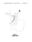 Resistance Feedback Laryngoscope diagram and image