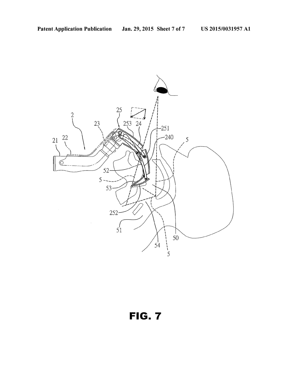 Resistance Feedback Laryngoscope - diagram, schematic, and image 08