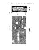 SYSTEM, METHOD AND DEVICE FOR MEASURING A GAS IN THE STOMACH OF A MAMMAL diagram and image