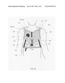 ADJUSTABLE THORACIC GARMENTS USEABLE BY PATIENTS HAVING DIFFERENT THORACIC     DIMENSIONS FOR LOCATING EM TRANSDUCER(S) IN PROXIMITY TO PREDEFINED     THORACIC ANATOMIC FEATURES diagram and image