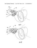 SURGICAL NAVIGATION DEVICES AND METHODS diagram and image