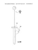 SURGICAL NAVIGATION DEVICES AND METHODS diagram and image