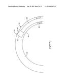 FFR SENSOR HEAD DESIGN THAT MINIMIZES STRESS INDUCED PRESSURE OFFSETS diagram and image