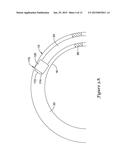 FFR SENSOR HEAD DESIGN THAT MINIMIZES STRESS INDUCED PRESSURE OFFSETS diagram and image