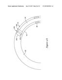 FFR SENSOR HEAD DESIGN THAT MINIMIZES STRESS INDUCED PRESSURE OFFSETS diagram and image