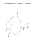 FFR SENSOR HEAD DESIGN THAT MINIMIZES STRESS INDUCED PRESSURE OFFSETS diagram and image