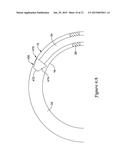 FFR SENSOR HEAD DESIGN THAT MINIMIZES STRESS INDUCED PRESSURE OFFSETS diagram and image