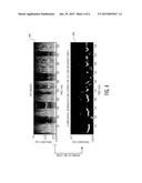 METHOD AND APPARATUS FOR PROVIDING A VISUAL REPRESENTATION OF SLEEP     QUALITY BASED ON ECG SIGNALS diagram and image