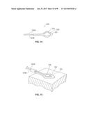 SYSTEMS AND METHODS FOR TREATMENT OF AN AIRWAY DISORDER diagram and image