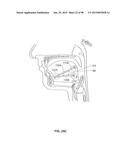 SYSTEMS AND METHODS FOR TREATMENT OF AN AIRWAY DISORDER diagram and image