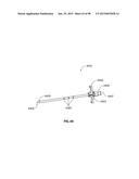 SYSTEMS AND METHODS FOR TREATMENT OF AN AIRWAY DISORDER diagram and image