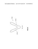 SYSTEMS AND METHODS FOR TREATMENT OF AN AIRWAY DISORDER diagram and image