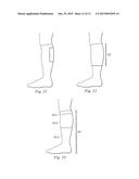 COMPRESSION SLEEVE AUGMENTING CALF MUSCLE PUMP diagram and image