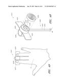 DEVICES FOR TREATING SKIN USING TREATMENT MATERIALS LOCATED ALONG A TIP diagram and image