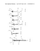 TRANSAPICAL MITRAL VALVE REPAIR METHOD diagram and image