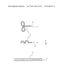 TRANSAPICAL MITRAL VALVE REPAIR METHOD diagram and image